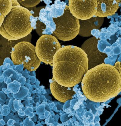 Studies highlight MRSA evolution and resilience Studies highlight MRSA evolution and resilience