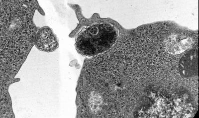 VCU researchers uncover molecular basis of infection of tick-transmitted disease VCU researchers uncover molecular basis of infection of tick-transmitted disease