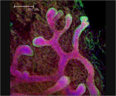 Salk scientists use an old theory to discover new targets in the fight against breast cancer