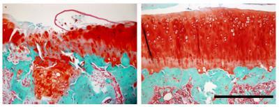 New theory on genesis of osteoarthritis comes with successful therapy in mice New theory on genesis of osteoarthritis comes with successful therapy in mice