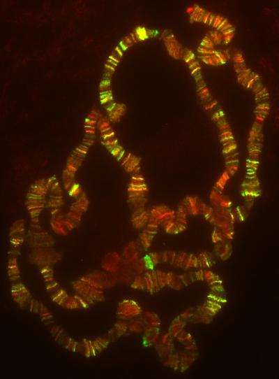 Lessons learned from yeast about human leukemia: The power of basic model organisms in human health