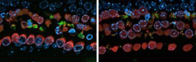 Kill the germs, spare the ears: How to create antibiotics that don't hurt hearing Kill the germs, spare the ears: How to create antibiotics that don't hurt hearing