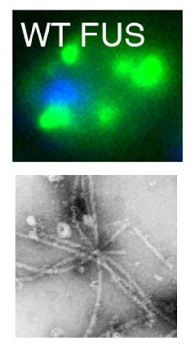 Studies of mutated protein in Lou Gehrigs disease reveal new paths for drug discovery Studies of mutated protein in Lou Gehrigs disease reveal new paths for drug discovery
