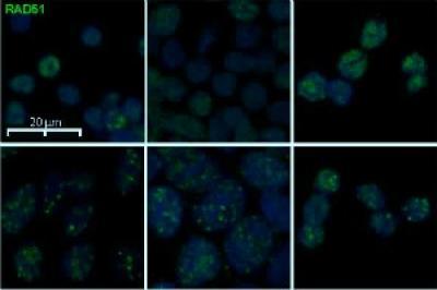 New class of cancer drugs could work in colon cancers with genetic mutation, U-M study finds New class of cancer drugs could work in colon cancers with genetic mutation, U-M study finds