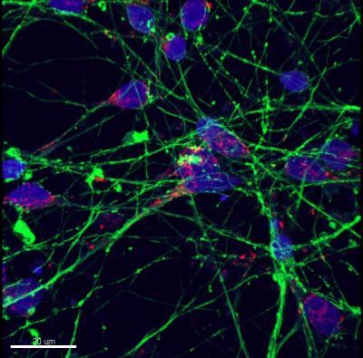 Huntington's disease mutation corrected in induced pluripotent stem cells Huntington's disease mutation corrected in induced pluripotent stem cells