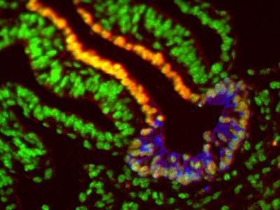 Predicting the fate of personalized cells next step toward new therapies Predicting the fate of personalized cells next step toward new therapies