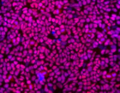 Scientists create stable, self-renewing neural stem cells Scientists create stable, self-renewing neural stem cells
