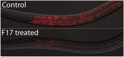 UCSF team shows how to make skinny worms fat and fat worms skinny