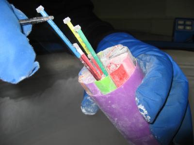 14 new biomarkers identified for type 2 diabetes 14 new biomarkers identified for type 2 diabetes
