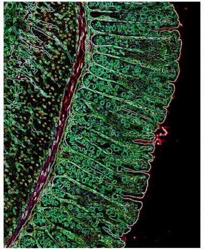 Border patrol: Immune cells protect body from invaders, according to Penn study