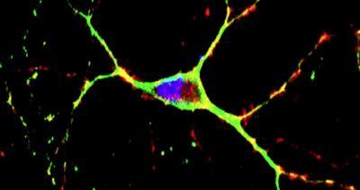 Berkeley Lab scientists help develop promising therapy for Huntington's disease Berkeley Lab scientists help develop promising therapy for Huntington's disease