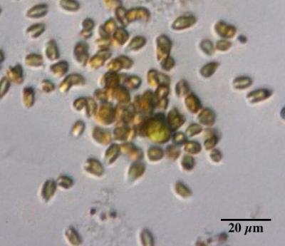 They hunt, they kill, they cheat: Single-celled algae shed light on social lives of microbes They hunt, they kill, they cheat: Single-celled algae shed light on social lives of microbes