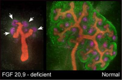 Clues Found to Way Embryonic Kidney Maintains Its Fleeting Stem Cells
