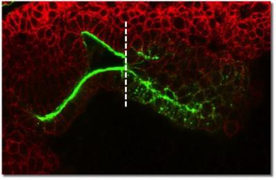 Researchers describe a new genetic program that converts static cells into mobile invasive cells