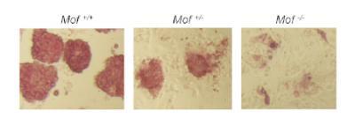 Stem cells can become anything - but not without this protein