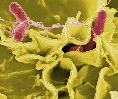 UCSB researchers find a way to detect stealthy, 'hypervirulent' Salmonella strains