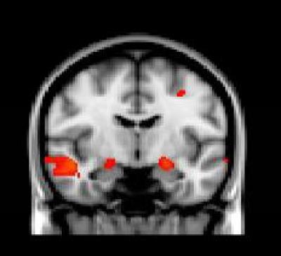 Brain responses to emotional images predict PTSD symptoms after Boston Marathon bombing Brain responses to emotional images predict PTSD symptoms after Boston Marathon bombing