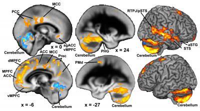 Family problems experienced in childhood and adolescence affect brain development Family problems experienced in childhood and adolescence affect brain development