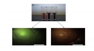 Tagging tumors with gold: Scientists use gold nanorods to flag brain tumors Tagging tumors with gold: Scientists use gold nanorods to flag brain tumors