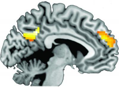 Certain parts of the brain activated in people who heard tailored health messages and quit smoking Certain parts of the brain activated in people who heard tailored health messages and quit smoking