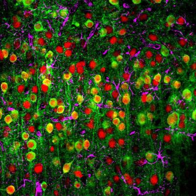 New mapping approach lets scientists zoom in and out as the brain processes sound New mapping approach lets scientists zoom in and out as the brain processes sound