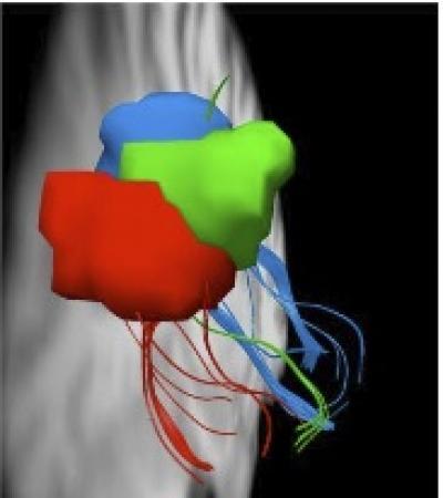 CMU neuroscientists identify how the brain works to select what we (want to) see CMU neuroscientists identify how the brain works to select what we (want to) see