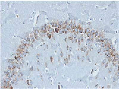 How does persimmon leaf flavonoid promote brain ischemic tolerance? How does persimmon leaf flavonoid promote brain ischemic tolerance?