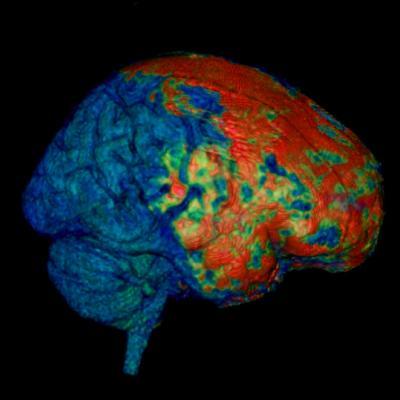 Concussion secrets unveiled in mice and people Concussion secrets unveiled in mice and people