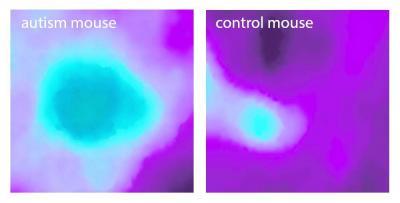 Insular cortex alterations in mouse models of autism Insular cortex alterations in mouse models of autism