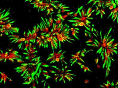 Human stem cells predict efficacy of Alzheimer drugs Human stem cells predict efficacy of Alzheimer drugs