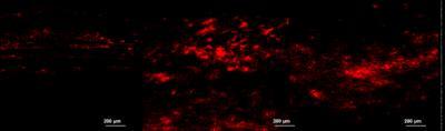 Periodontal tissue differentiation of SC is expected to repair peripheral nerve injury Periodontal tissue differentiation of SC is expected to repair peripheral nerve injury