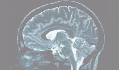 Positive, negative thinkers' brains revealed Positive, negative thinkers' brains revealed