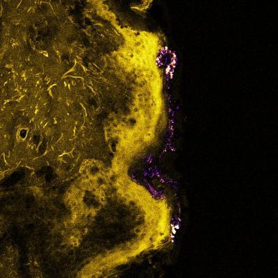Scientists use laser imaging to assess safety of zinc oxide nanoparticles in sunscreen Scientists use laser imaging to assess safety of zinc oxide nanoparticles in sunscreen