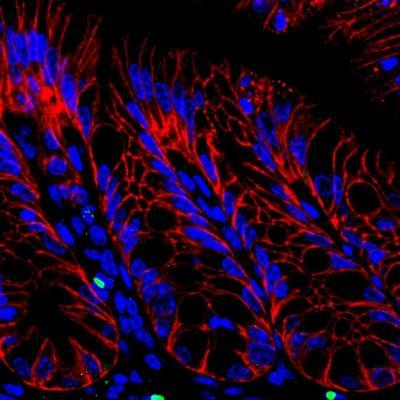 Penn study shows how immune system peacefully co-exists with 'good' bacteria Penn study shows how immune system peacefully co-exists with 'good' bacteria