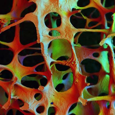 New study suggests moderate alcohol consumption may help prevent bone loss New study suggests moderate alcohol consumption may help prevent bone loss