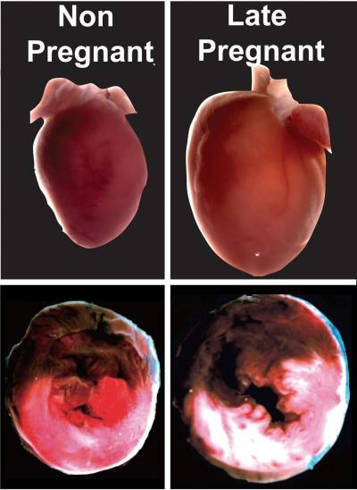 UCLA study looks at why heart attacks cause so much more damage in late pregnancy UCLA study looks at why heart attacks cause so much more damage in late pregnancy