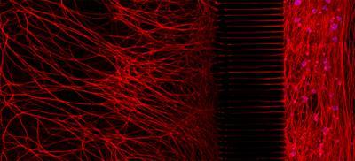 The secret lives, and deaths, of neurons The secret lives, and deaths, of neurons