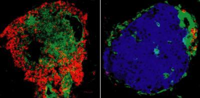 Antibodies reverse type 1 diabetes in new immunotherapy study