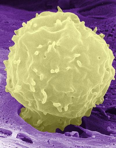 Neutrophils: White blood cells mediate insulin resistance