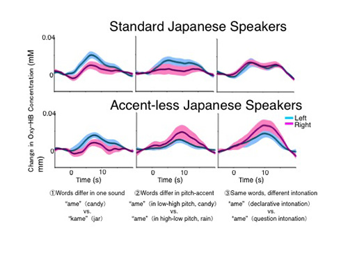 Brain Areas That Process Spoken Language Impacted By Learning Dialects