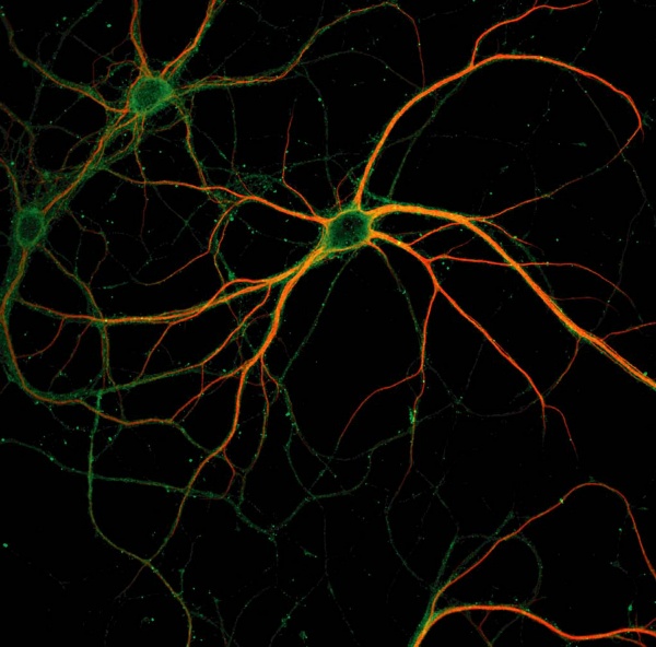 Photograph of a stained neuron