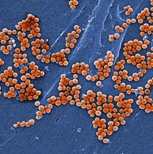 mrsa genome sequencing transmission traces setting aureus staphylococcus scanning micrograph methicillin