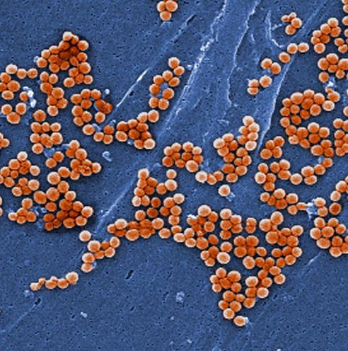 mrsa genome sequencing transmission traces setting aureus staphylococcus scanning micrograph methicillin