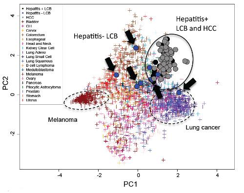 Hot on the trail of the hepatitis-liver cancer connection | Science Codex