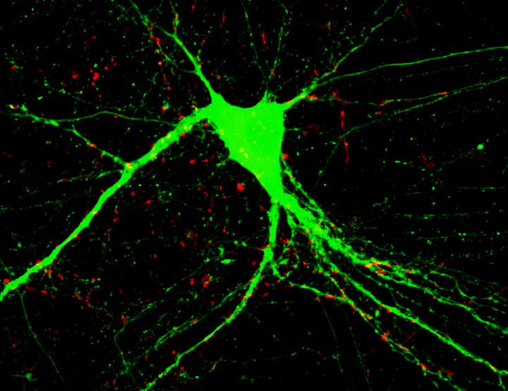 Genes, Schizophrenia, And Repairing The Brain | Science 2.0
